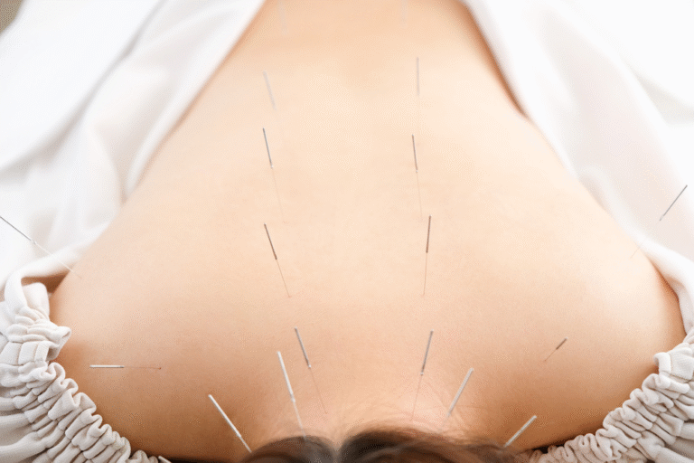 therapeutic massage acupuncture - Victoria Park